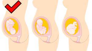 图片[2]-胎儿的出生（自然分娩+剖腹产）-性教育网