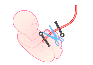 图片[6]-胎儿的出生（自然分娩+剖腹产）-性教育网