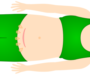 图片[10]-胎儿的出生（自然分娩+剖腹产）-性教育网