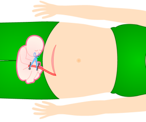 图片[12]-胎儿的出生（自然分娩+剖腹产）-性教育网