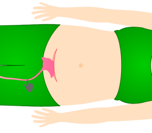图片[13]-胎儿的出生（自然分娩+剖腹产）-性教育网